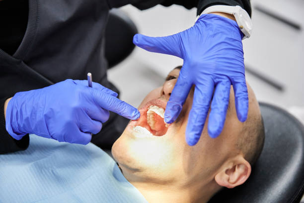Best Emergency Tooth Extraction in Fairmont, WV